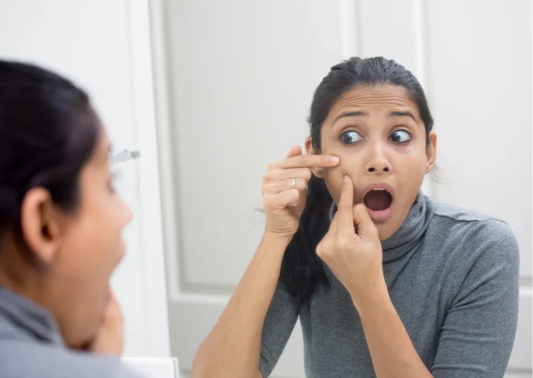 Masturbation and Pimples