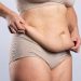 How to Get Rid of a Hanging Belly After a C-Section