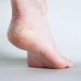 How to Remove Thick Dead Skin from Feet